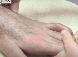 Գյումրու Վերականգնողական կենտրոնում բուժում է ստանում շուրջ 5 տասնյակ զինծառայող