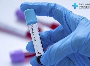 309 случаев коронавируса за сутки, проведено 1462 тестирования