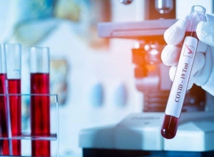 В Арцахе подтверждён 1 новый случай коронавирусной болезни