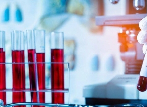 В Арцахе подтверждено 7 новых случаев заражения коронавирусом