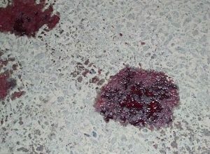 Դանակահարություն Նոր Խարբերդում