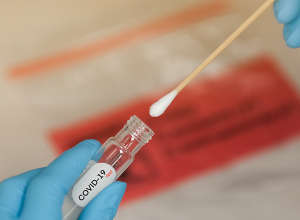 В Армении выявлено 10 случаев заражения британским штаммом нового коронавируса