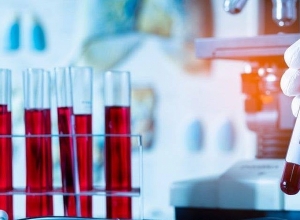 В Арцахе подтверждено 8 случаев коронавирусного заболевания