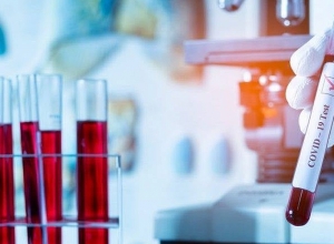 В Арцахе подтверждено 2 случая коронавирусного заболевания