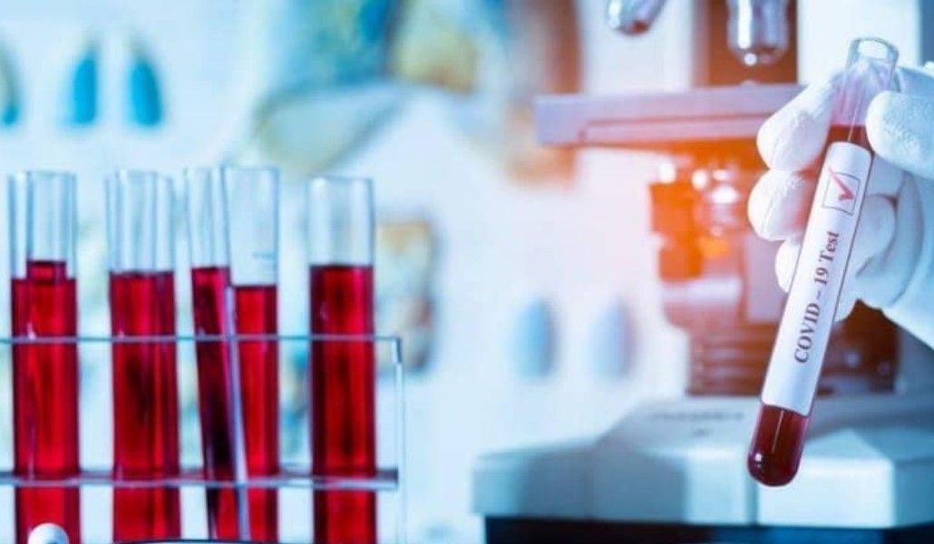 կորոնավիրուս