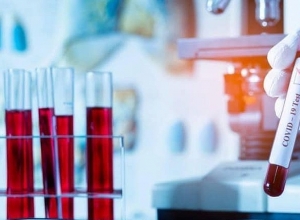 Подтверждено 140 новых случаев коронавирусного заболевания