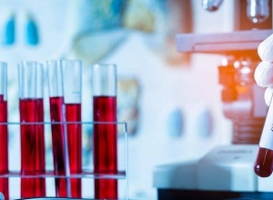 В Арцахе подтверждено 4 случая коронавирусной болезни