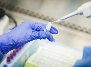 За сутки в Армении подтверждено 3 случая коронавируса: летальных исходов не зарегистрировано