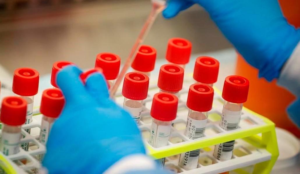 կորոնավիրուս թեստավորում