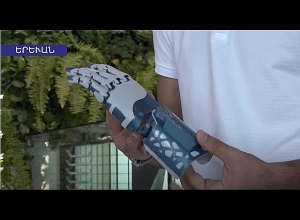 Դիջիթեյնի M1TQ ծրագրում հաղթել է սփյուռքահայերի պրոթեզների մասին ստարտափը