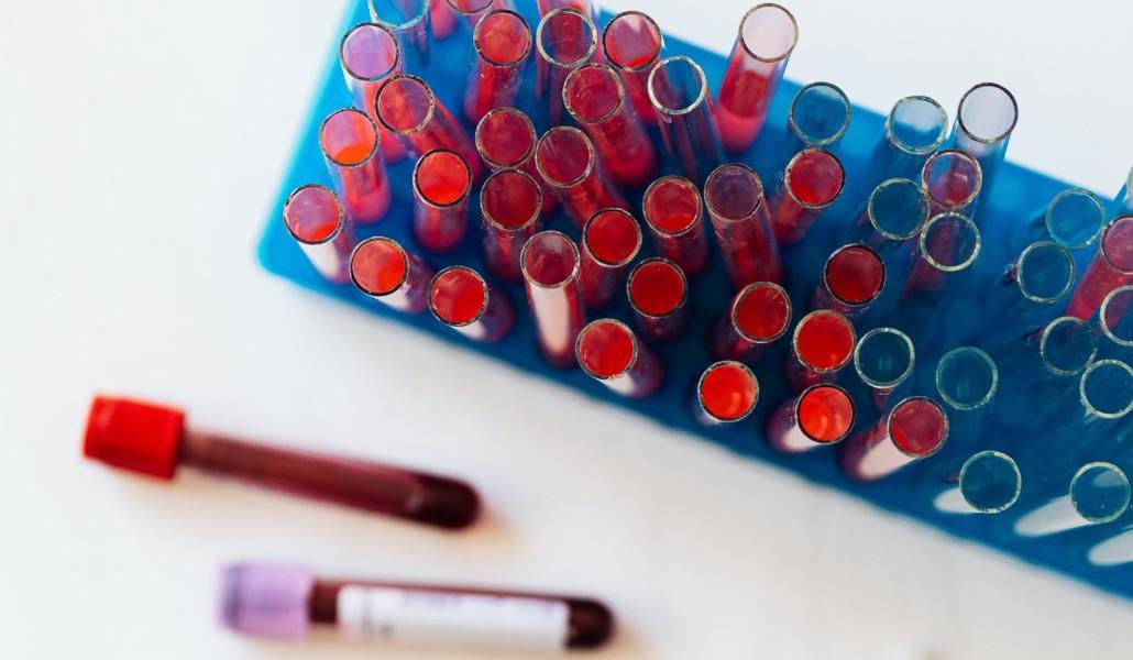 կորոնավիրուս թեստ