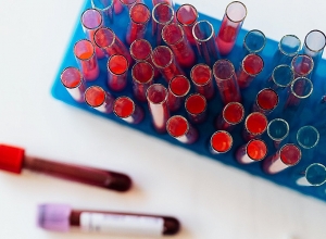 Подтверждено 494 новых случаев заражения коронавирусной болезнью