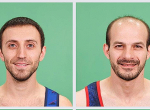 Հայաստանի չորս մարմնամարզիկներ մտել են աշխարհի առաջնության եզրափակիչ փուլ