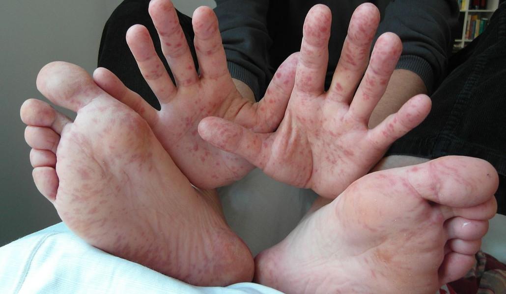 357443591_578034864509867_1999753478497750265_n