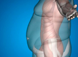 Որո՞նք են ճարպակալման պատճառները, եւ ի՞նչ անել՝ դրանից խուսափելու համար