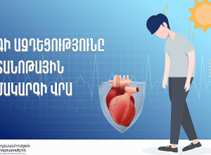 Շոգն էական ազդեցություն կարող է ունենալ սրտանոթային համակարգի վրա