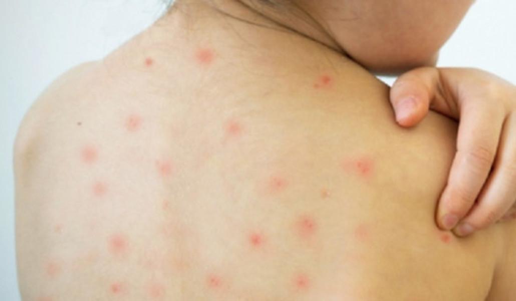 32458_thumb_v1.thumb