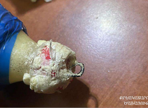 Սևան ՔԿՀ-ում դրոնի միջոցով փորձել են փոխանցել բջջային հեռախոսներ