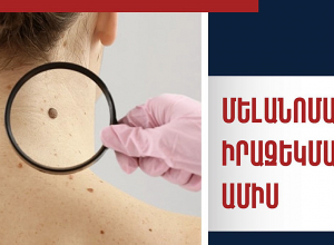 Մելանոմայի իրազեկման ամիս